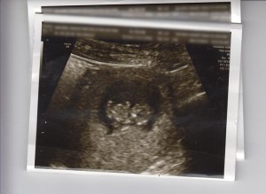Ultrasound Pic