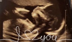 A faded black and white ultrasound with "I heart you" written in cursive